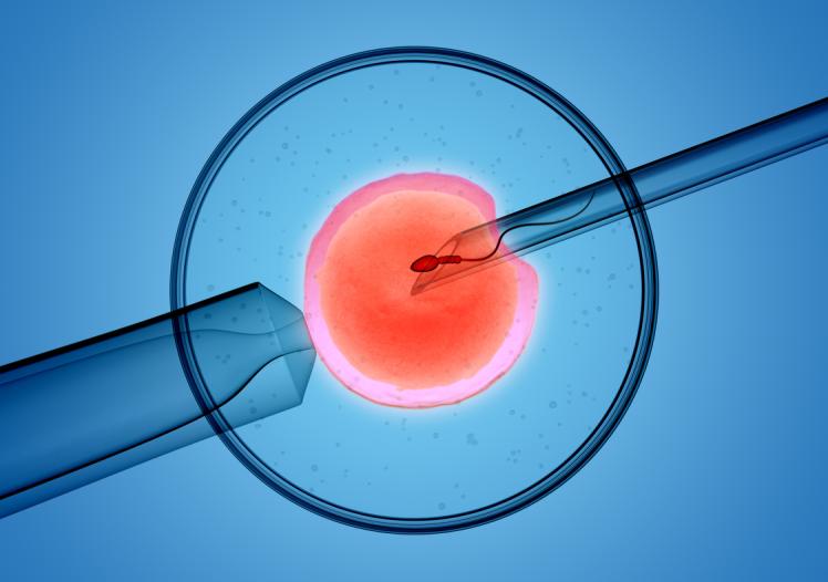 iVF