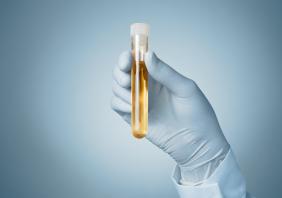 Doctor's hand with urine sample