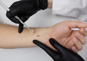 Human microchipping
