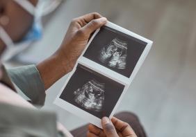 Ultrasound 
