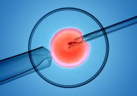 iVF
