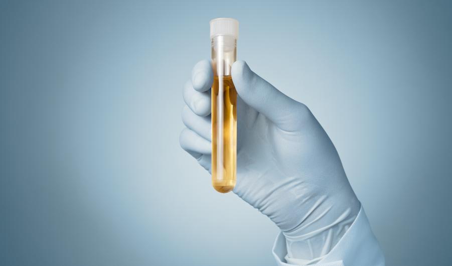 Doctor's hand with urine sample