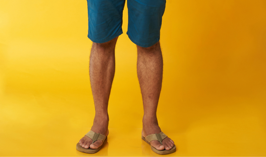 Shorts and flip flops to work