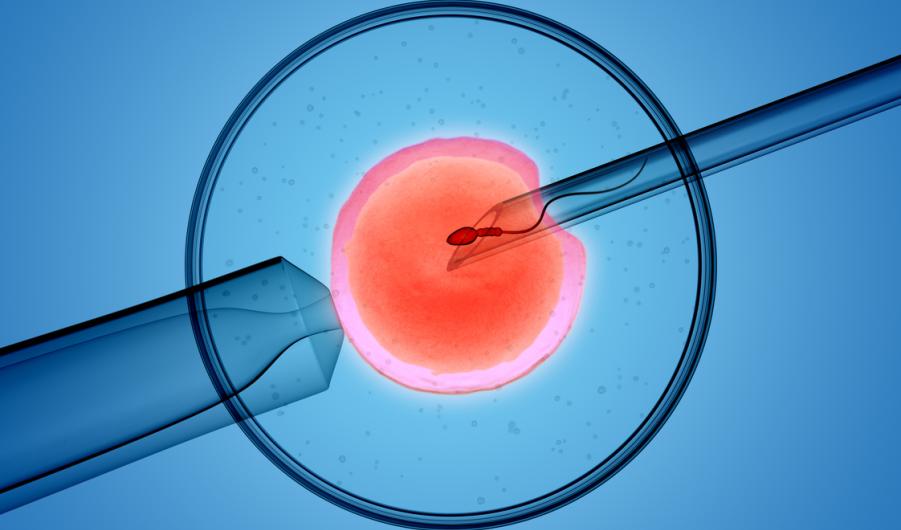 iVF